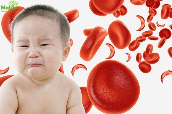 Sức khỏe của trẻ bị thiếu máu có thể bị ảnh hưởng nghiêm trọng nếu không điều trị kịp thời