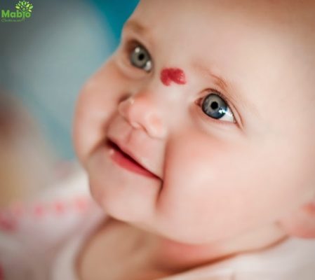 Điều trị u máu ở trẻ sơ sinh muộn có thể để lại nhiều di chứng đáng tiếc
