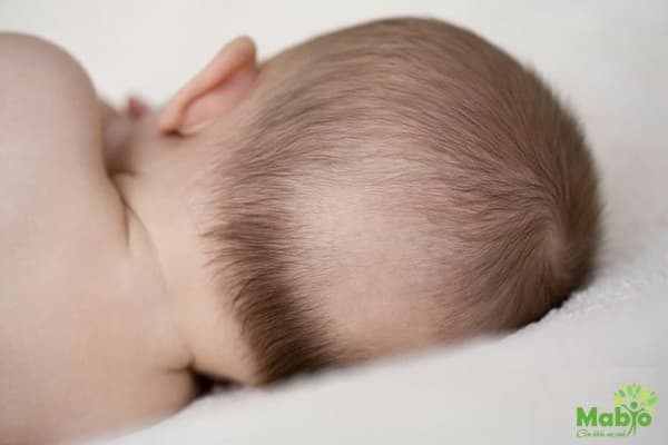 Đa số trường hợp trẻ sơ sinh rụng tóc là vấn đề sinh lý bình thường