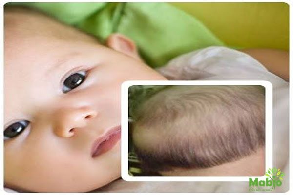 Rụng tóc ở trẻ sơ sinh là tình trạng khá phổ biến